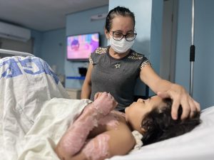 Cirurgião Plástico do HGE alerta sobre os cuidados para evitar queimaduras