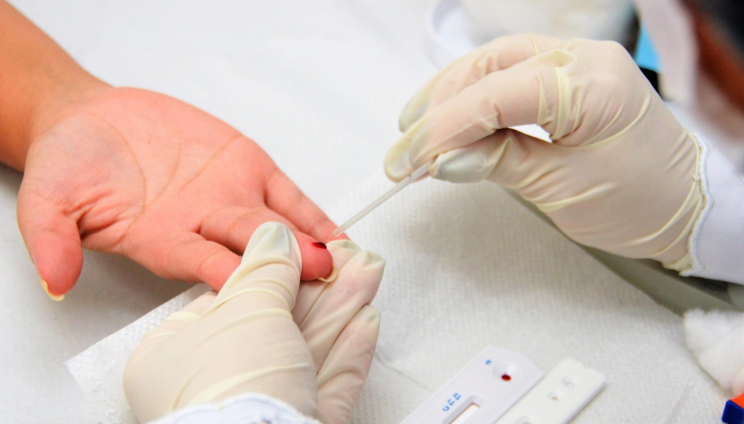 Leia mais sobre o artigo Sesau promove Webinar sobre o Plano de Eliminação das Hepatites Virais