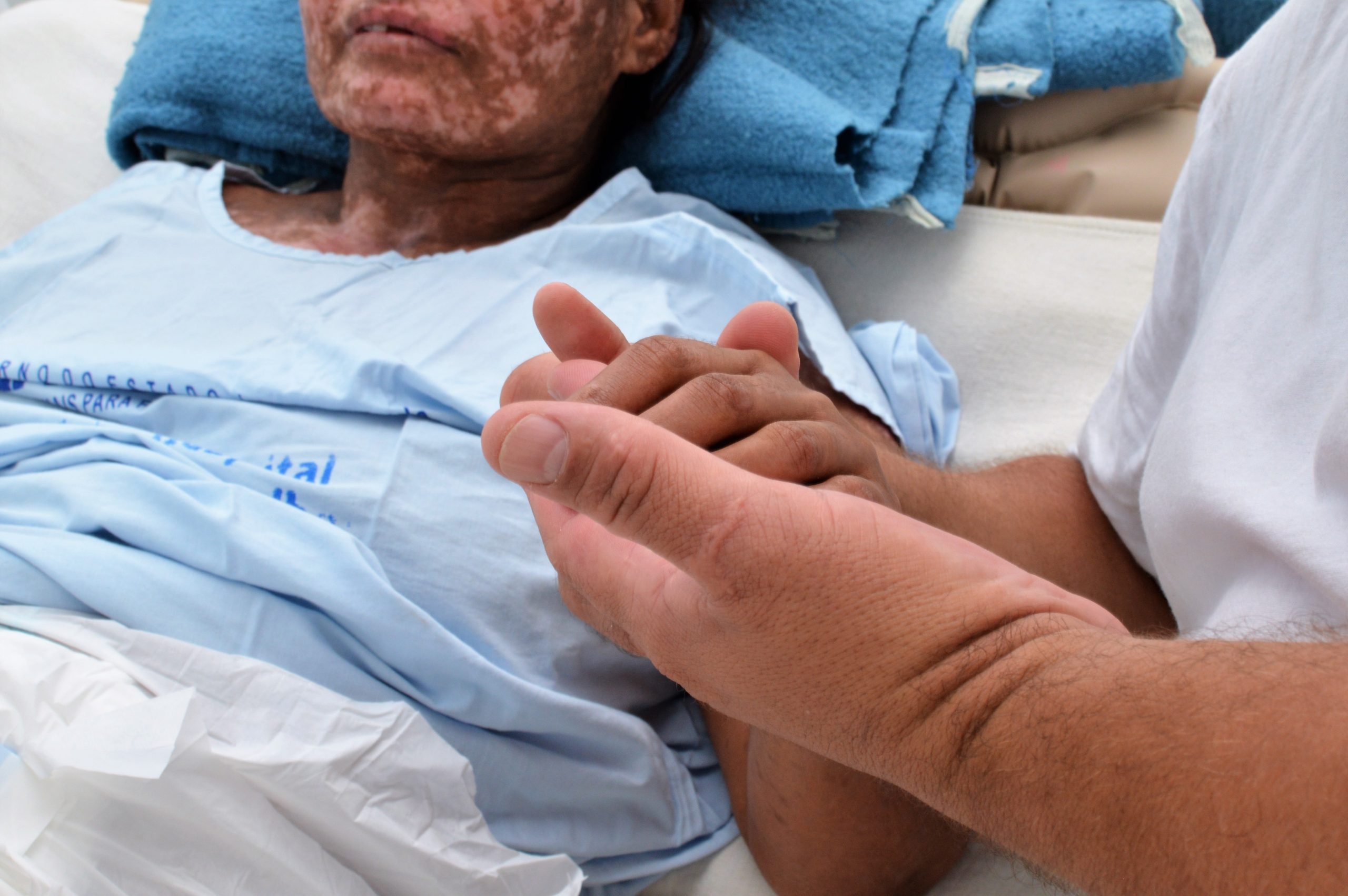 Leia mais sobre o artigo Dona de casa que desenvolveu síndrome rara após reação alérgica a medicamento recebe alta