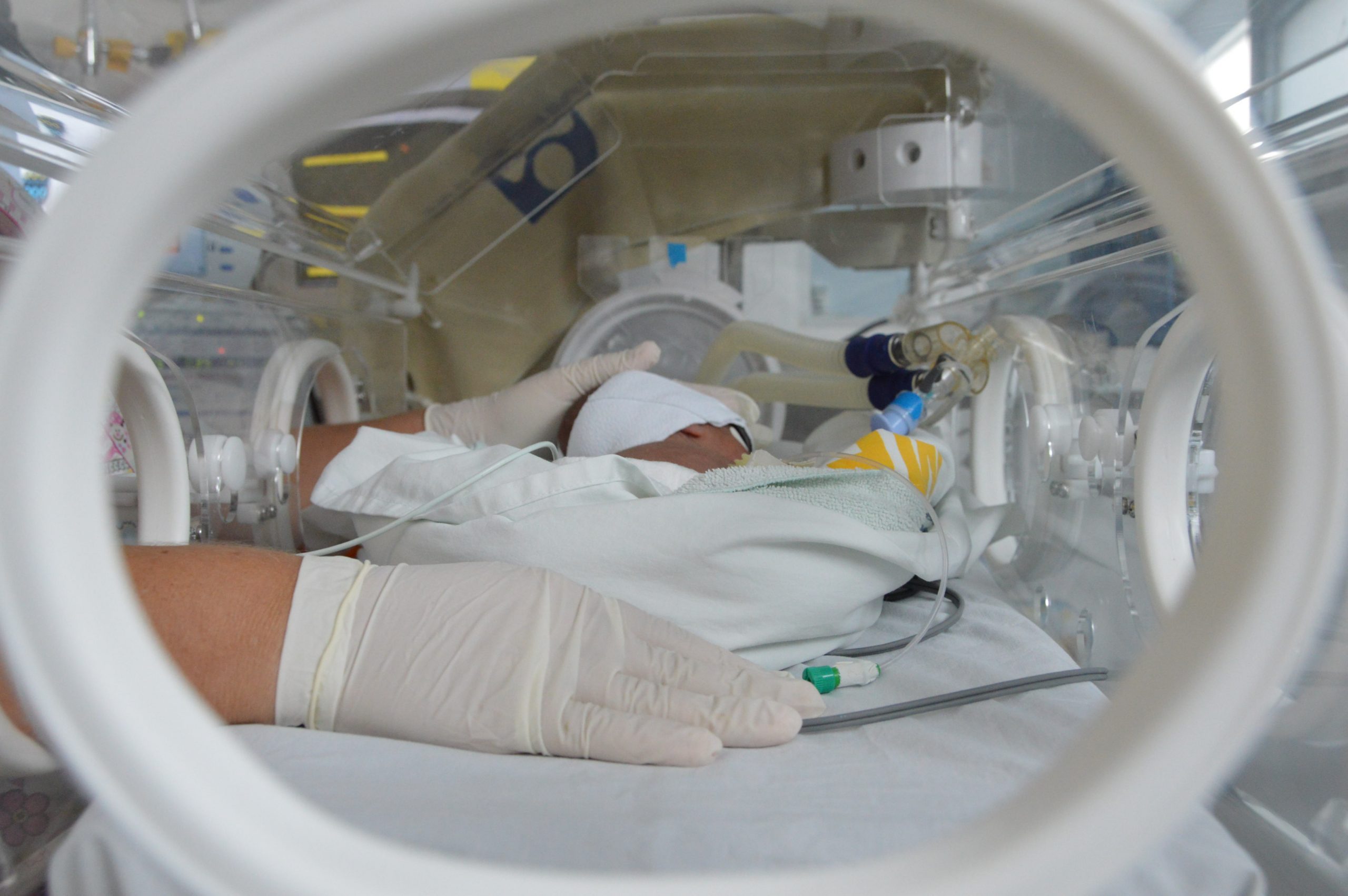 Leia mais sobre o artigo Sesau retoma cirurgias do Programa Estadual de Cardiopediatria nesta quinta-feira (7)
