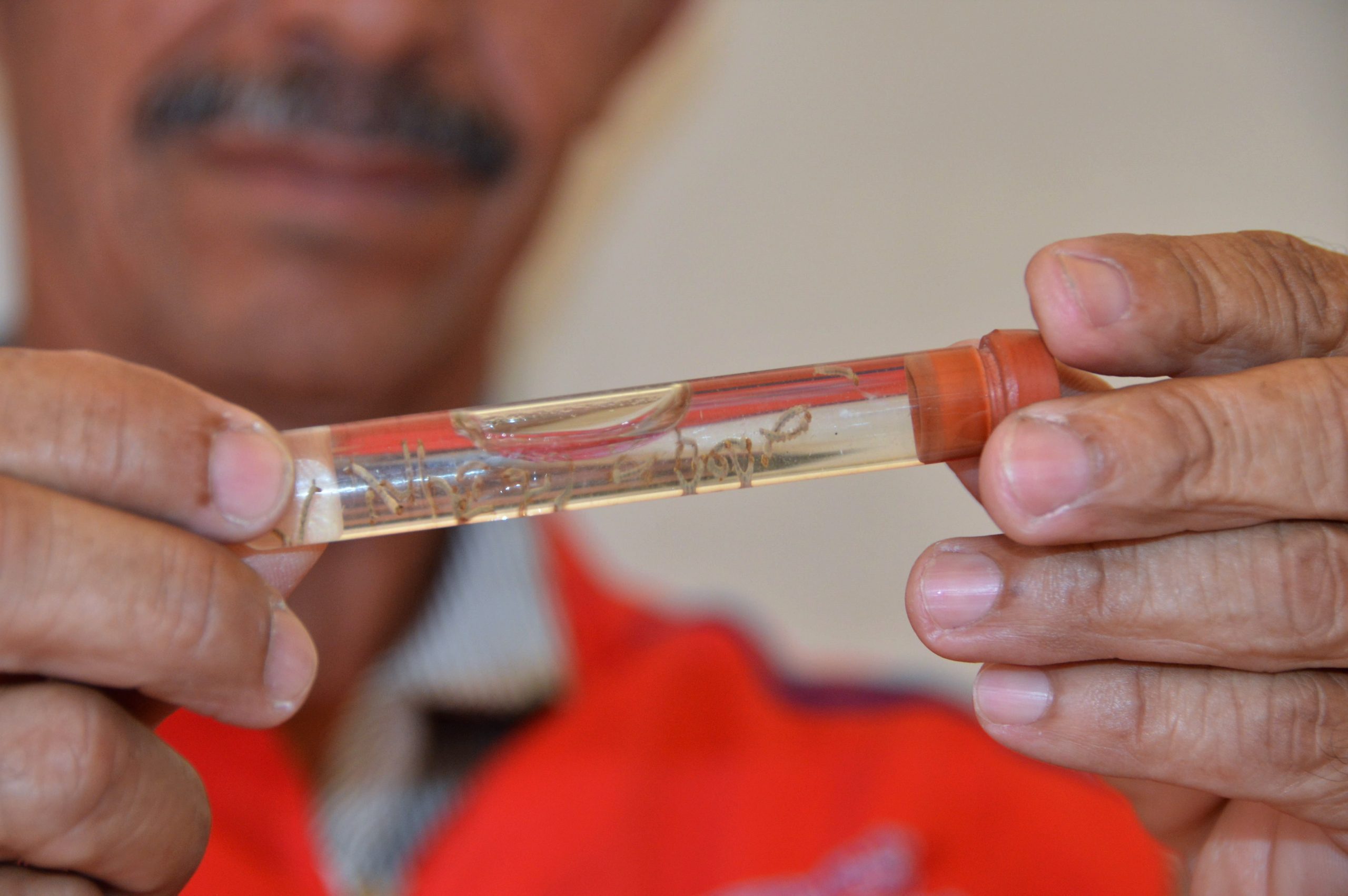 Leia mais sobre o artigo Sesau registra redução nos casos de dengue e zika em 2025, mas alerta para prevenção no verão