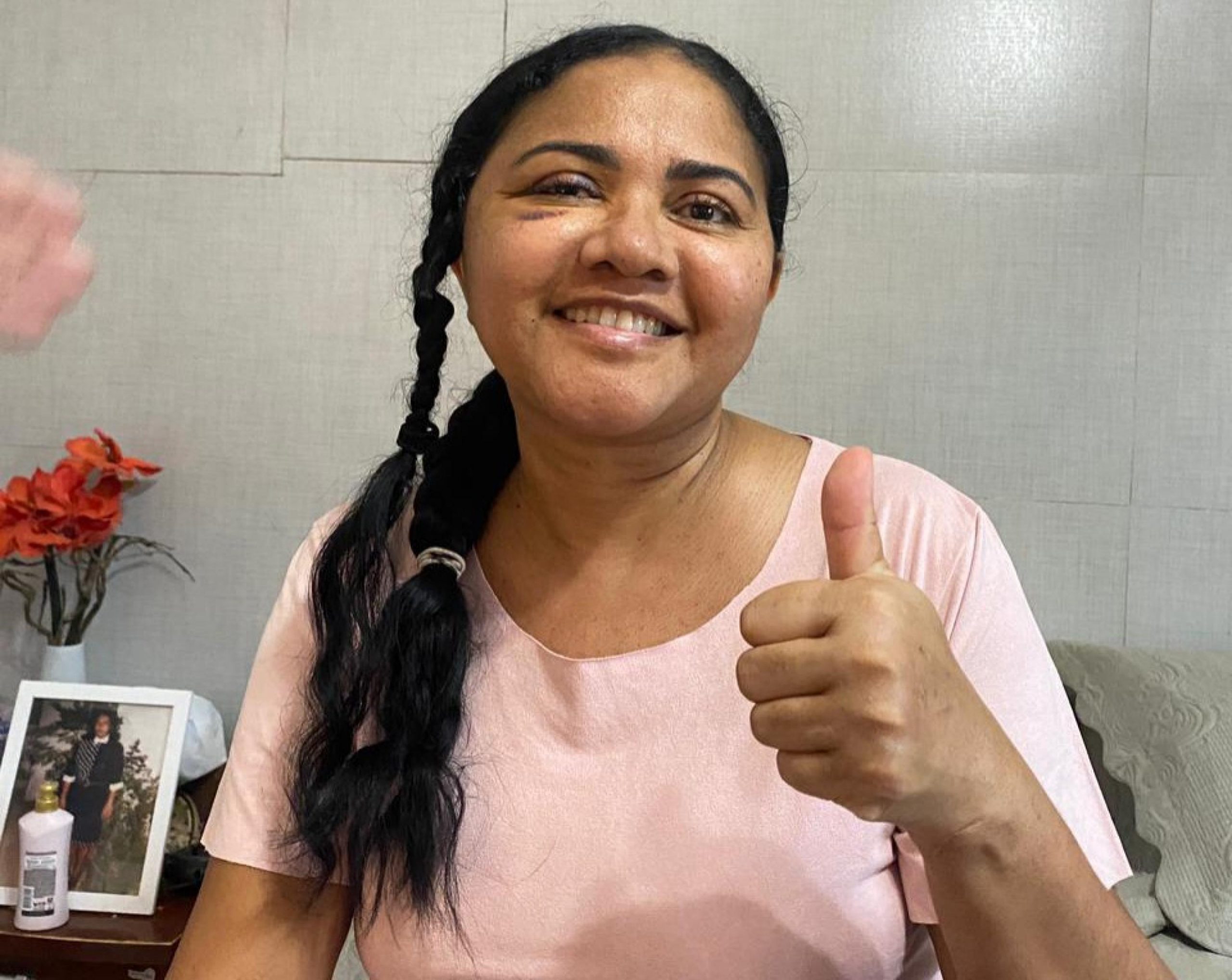 Leia mais sobre o artigo Paciente do Hospital Metropolitano de Alagoas recupera visão após cirurgia complexa