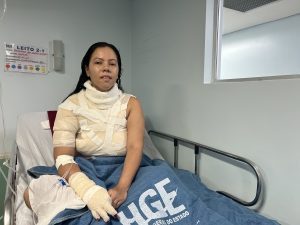 Cirurgião Plástico do HGE alerta para o risco de queimaduras durante o cozimento de alimentos para as festas de São Pedro