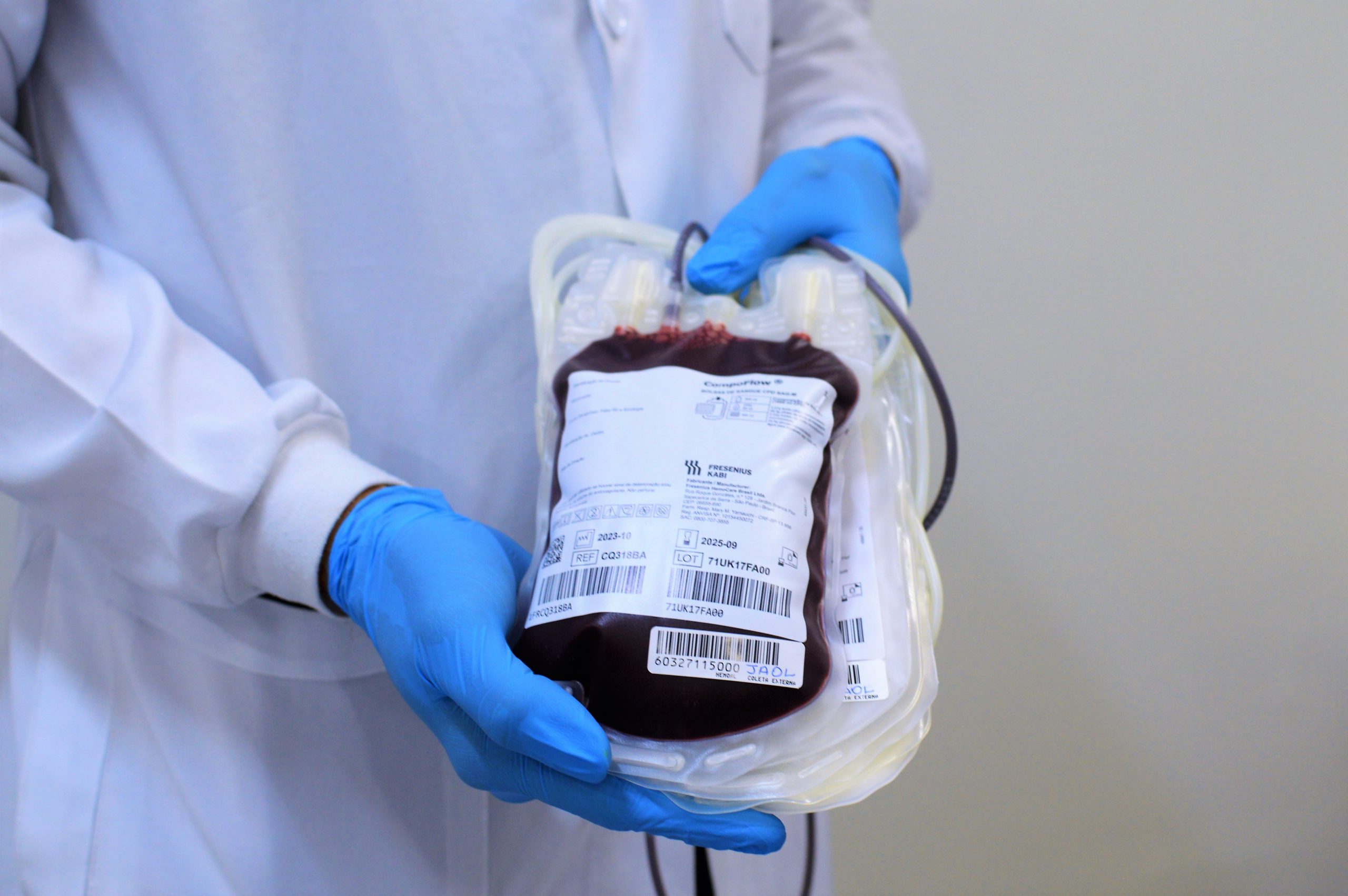 Leia mais sobre o artigo Hemoal faz coletas externas de sangue em Arapiraca e Murici nesta terça-feira (9)
