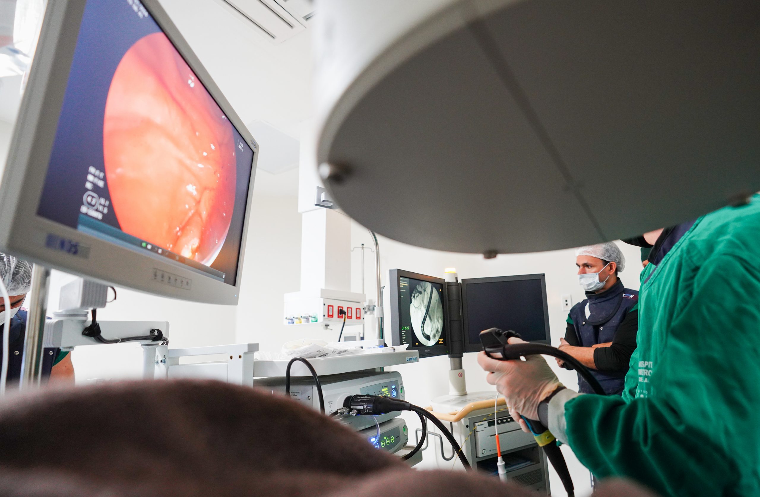 Leia mais sobre o artigo I Semestre: Hospital Metropolitano salva 175 vidas com endoscopia para desobstruir canais do fígado e pâncreas