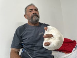 HGE evita amputação da mão esquerda de técnico em eletrônica