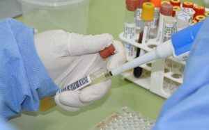 Sesau segue monitorando casos de Febre do Oropouche em Alagoas