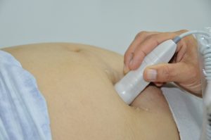 Secretaria de Estado da Saúde abre inscrições para o IX Fórum Perinatal de Alagoas de 2024