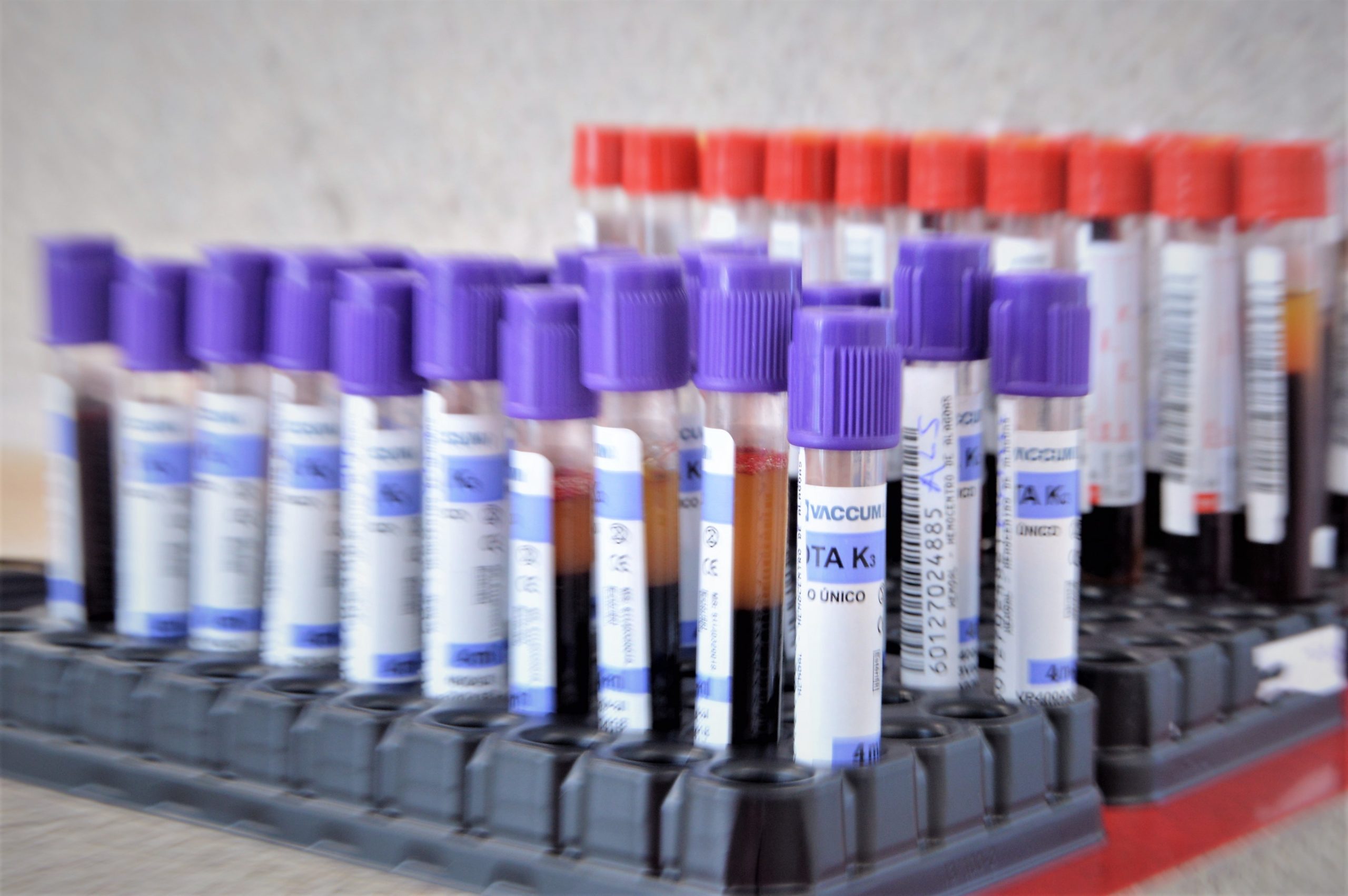 Leia mais sobre o artigo Hemoal registra aumento de 120% no número de alagoanos cadastrados para doação de medula óssea