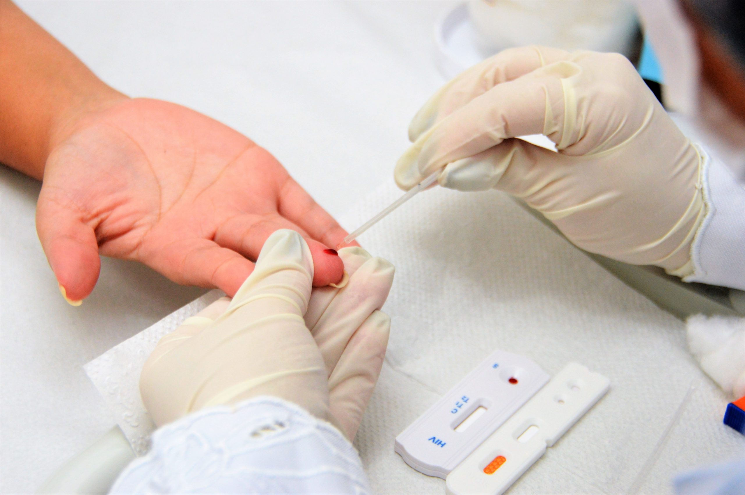 Leia mais sobre o artigo Sesau orienta sobre as medidas para evitar as hepatites virais