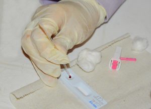 Sesau abre inscrições para o Curso sobre as Diretrizes de Diagnóstico do HIV, Hepatites e Sífilis