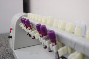 Biomédica do Hospital Ib Gatto Falcão reforça a importância dos exames laboratoriais para detecção de doenças respiratórias na quadra chuvosa
