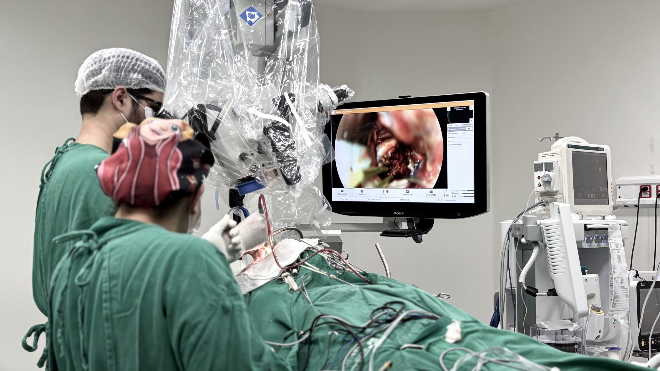 Leia mais sobre o artigo Hospital Metropolitano de Alagoas realiza cirurgia de alta complexidade em paciente com tumor intracraniano