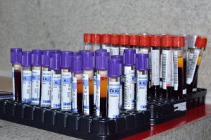 Vírus HTLV: Enfermeira da Sesau esclarece como se prevenir, diagnosticar e tratar pelo SUS