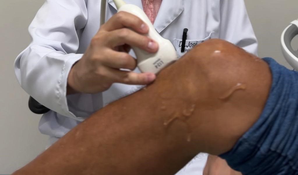 Leia mais sobre o artigo Serviço de Ultrassonografia do Hospital Metropolitano de AL revela impactos de contusão no joelho e orienta tratamento ortopédico