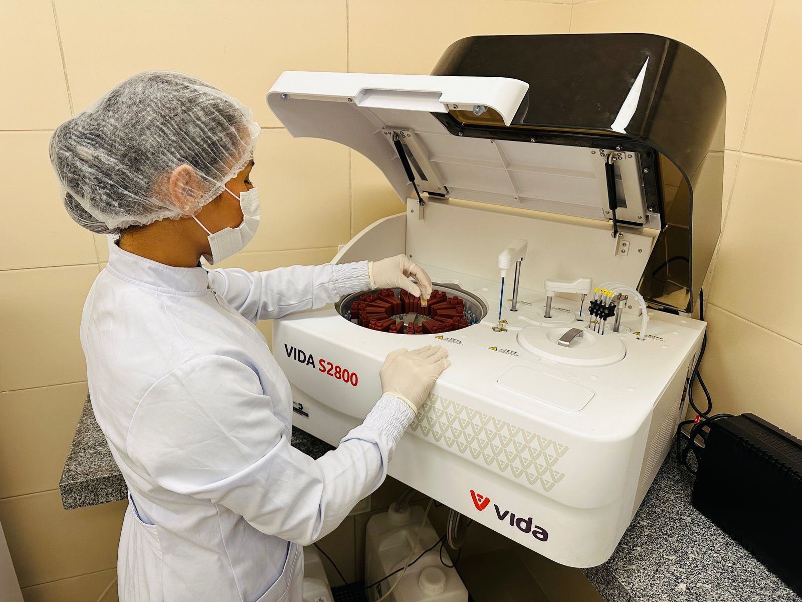 Leia mais sobre o artigo Laboratório do Hospital Regional de Palmeira dos Índios agiliza diagnósticos com equipamentos de última geração