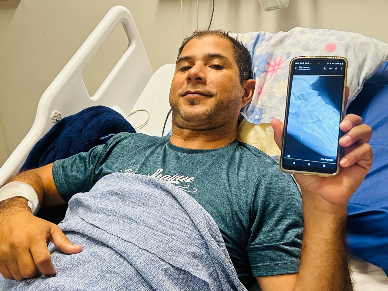 Leia mais sobre o artigo Homem é submetido à cirurgia no HRPI após acidente com ferrão de peixe e faz alerta sobre o perigo