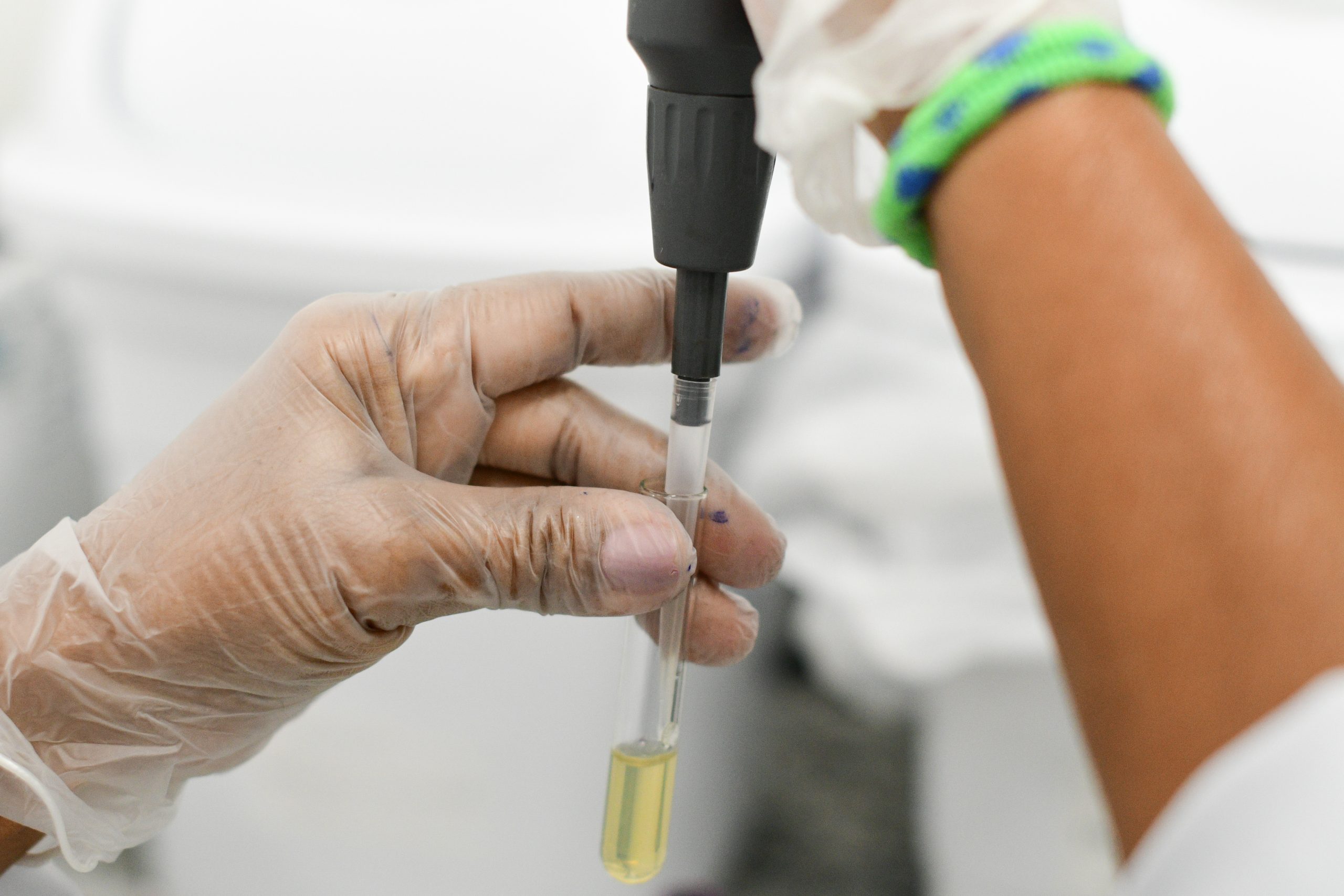 Leia mais sobre o artigo Quase 300 hemofílicos têm acesso a assistência integral do Hemocentro de Alagoas